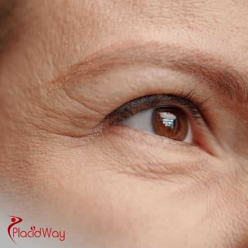 See the World Clearly Again: Understanding the Cost of Stem Cell Therapy for Macular Degeneration in Mexico